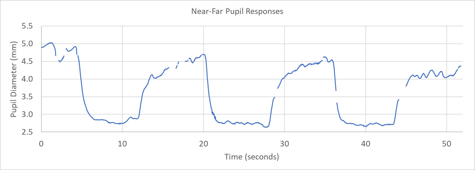 pupil response to blinks