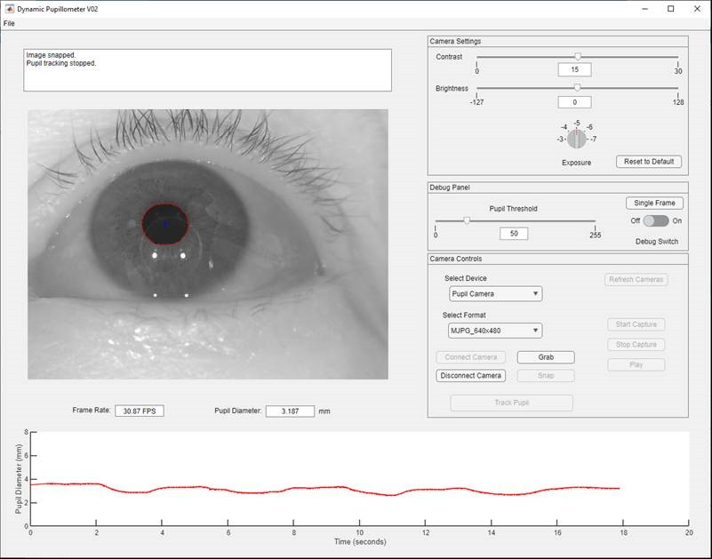 pupil response to blinks